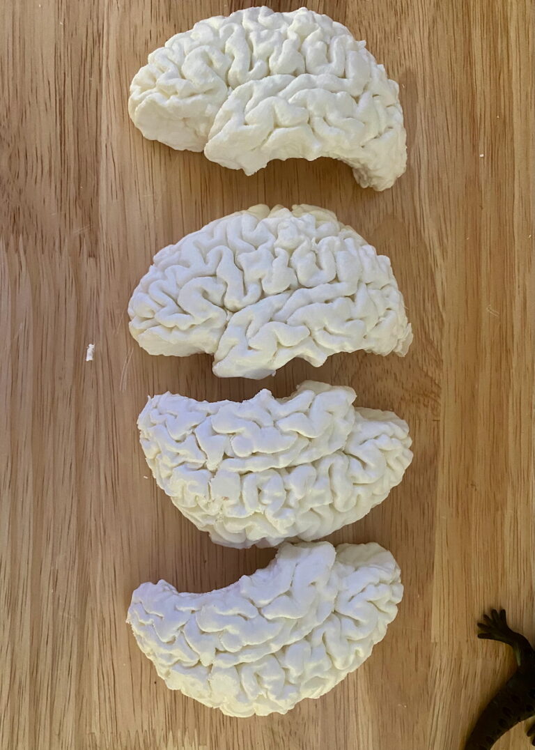 If you are taking Cognitive Neuroscience with Prof. Nyhus you will be seeing (and coloring) these brain parts this semester.